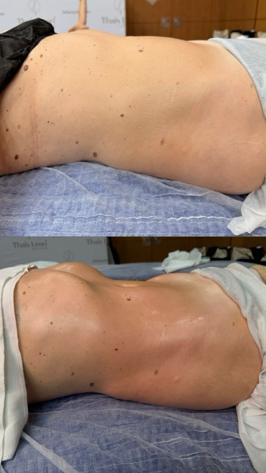 LYMPHATIC DRAINAGE ART Method treatment in Estepona